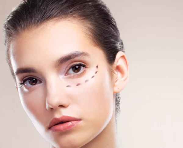 Blog - Intrigue Cosmetic Clinic