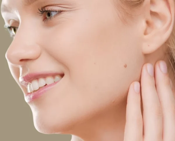 Blog - Intrigue Cosmetic Clinic